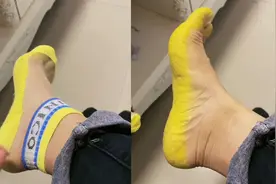 女子夜市买新袜子，穿一天后脚底板被染成黄色洗不掉，结局亮了！