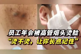 高管年会用烟头烫员工脸，“长长记性”，高管要承担什么法律责任视频封面