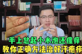 手上起小水泡，季节交替时反复发作？医生教你三招正确治疗汗疱疹视频封面