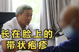 长到脸上的带状疱疹，患者直言：晚上疼得受不了啦！视频封面