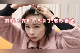 前额地方头发很稀,想用刮头皮来改善一下,50天刮了5次头皮了