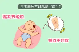 宝宝腿纹不对称？可能是髋关节脱位，尽早治疗免得变成长短腿！视频封面