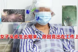 女子头皮发痒，医院开刀从头皮下取出六条蛆，放碗里竟还在蠕动！视频封面