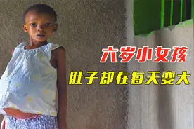 非洲小女孩 肚子每天在变大 疼到无法睡觉 医生却推荐去印度治疗视频封面