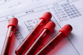 血管斑块如何清除？吃药能抗斑块吗？心血管医生为您解答！视频封面