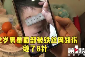 重庆2岁男童面部被小区铁丝网划伤视频封面