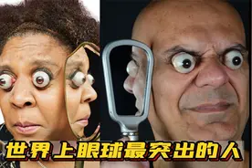 世界上眼球最突出的三个人，眼睛瞪得像铜铃，外星人的既视感视频封面