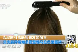 头皮屑可能是脱发的祸首！头皮屑增多警惕马拉色菌感染|生活提示视频封面