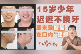 15岁少年大牙迟迟不冒头，咀嚼功能大受影响，急坏家长！视频封面