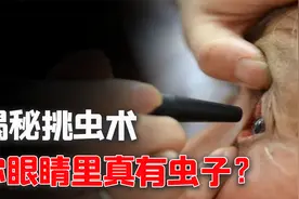 揭秘民间千古奇术：挑虫术，我们眼睛里真有虫子？其实原理很简单视频封面