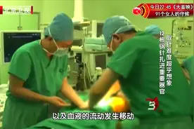 女婴体内扎进12根钢针，取针手术如同在大海里捞针|生命缘视频封面