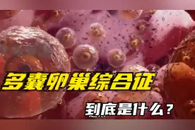 什么是多囊卵巢综合征？看完这段就明白，涨知识了视频封面