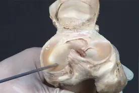 人体骨关节解刨学：8.3膝关节视频封面