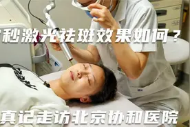 皮秒激光祛斑效果怎么样？三周真实记录！真记走访北京协和医院视频封面