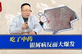 吃了中药，银屑病反而大爆发？缺了辨证论治视频封面