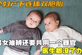 孕妇产下连体双胞胎，男女难辨还要共用一个器官，医生都没了办法视频封面