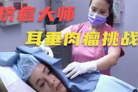 美女耳朵自带耳钉，看李医生如何轻松取下！视频封面