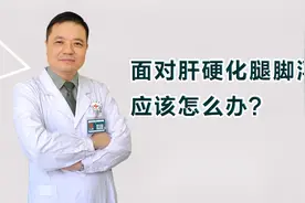 面对肝硬化腿脚浮肿应该怎么办？视频封面