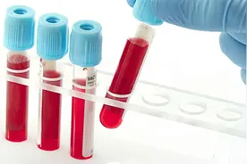 抽血发现总胆红素高怎么回事？是肝病惹的祸？医生带你看化验单