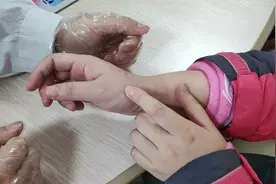手腕不敢往下、大拇指一活动手腕儿就疼，什么问题？视频封面