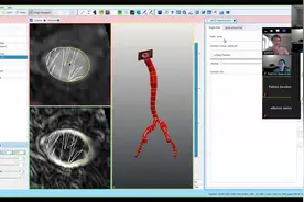 SimVascular Tutorial 4 Machine Learning 2D Segmentation