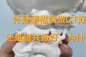 怀疑颈椎病是做CT好还是磁共振好，CT如何分辨椎间盘突出视频封面
