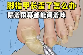 脚指甲又长又厚该怎么办？修脚时隔着屏幕能闻着味！全程超级解压视频封面