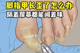 脚指甲又长又厚该怎么办？修脚时隔着屏幕能闻着味！全程超级解压视频封面