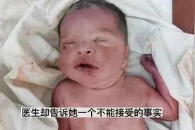 产妇整个子宫内没有羊水，宝宝生下来后，医生都直呼奇迹