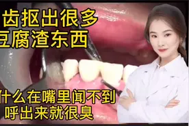 牙齿抠出来的像豆腐渣一样东西 嘴巴不臭 呼出来怎么这么臭 原因视频封面