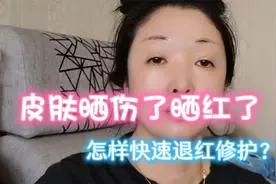 夏天皮肤晒伤了晒红了？教你快速又省钱的好方法，5分钟退红修护视频封面
