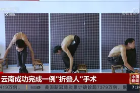 云南成功完成一例“折叠人”手术视频封面