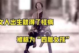 女孩出生得了怪病，竟有四条腿，被称为怪胎桃金娘视频封面
