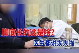 脚底长的这是啥？像个肉球，走路一踩就裂！医生直呼怎么这么大视频封面