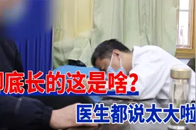 脚底长的这是啥？像个肉球，走路一踩就裂！医生直呼怎么这么大视频封面