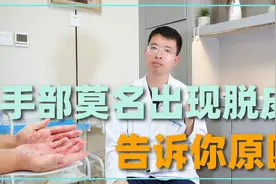 手部总是莫名出现脱皮，说明了什么别猜了，告诉你原因视频封面