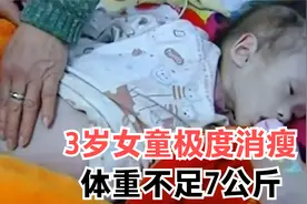 3岁女童瘦骨嶙峋，体重不足7公斤，肚子却肿到篮球那么大视频封面