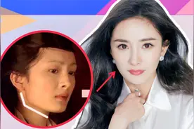 杨幂整容大盘点：从16岁到34岁，你以为她只削过骨吗？视频封面