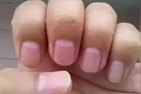 手指甲根部的“月牙白”，如果变多了意味着什么？很多人都不知道视频封面
