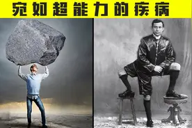 宛如超能力的疾病！石人综合征？身体变成像石头一样的雕像？视频封面