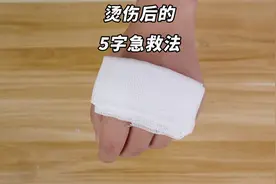 烫伤后别傻傻抹牙膏了，教你5字急救法，缓解疼痛，好多人说有用视频封面