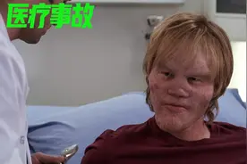 医疗故事 ，现实中的真实病例，狮面人，整个脸部如同一只狮子！视频封面