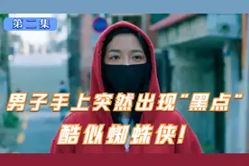 男人一觉起来，手上突然出现几个“黑点”，酷似蜘蛛侠！视频封面