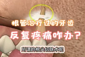 根管治疗过的牙齿又发炎疼痛了怎么办？根尖手术切断病根视频封面