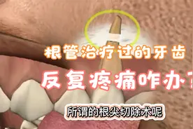 根管治疗过的牙齿又发炎疼痛了怎么办？根尖手术切断病根视频封面