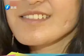 江苏南京：患罕见半侧颜面短小症，女子20年盼“蜕变”视频封面