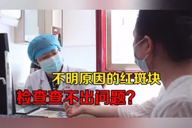 全身不明原因起红色斑块，一检查都正常，女子着急询问医生视频封面