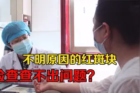 全身不明原因起红色斑块，一检查都正常，女子着急询问医生视频封面
