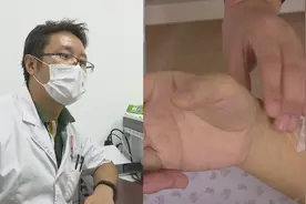 浑身出现游走性剧痛，女子关节畸变险些致残？医生：与天气有关视频封面