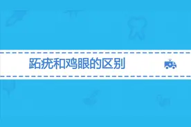 跖疣和鸡眼有什么不一样？医生教你正确辨别